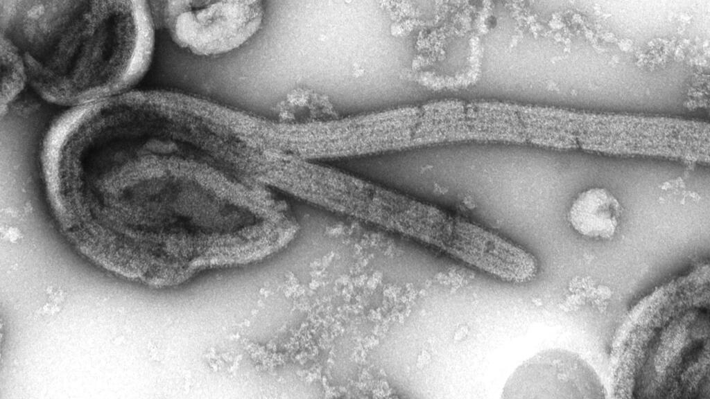 Le Ghana en état d'alerte Deux cas confirmés du virus Marburg